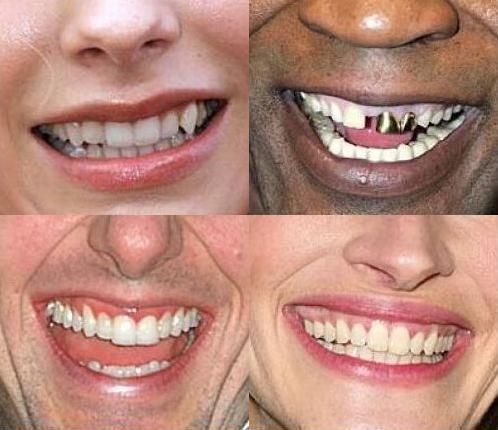 Cамые некрасивые зубы знаменитостей (9 фото + текст)