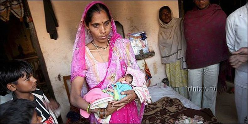 В Индии родилась девочка с двумя лицами (4 фото)