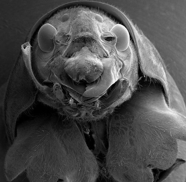 Микробы под ногтями под микроскопом фото