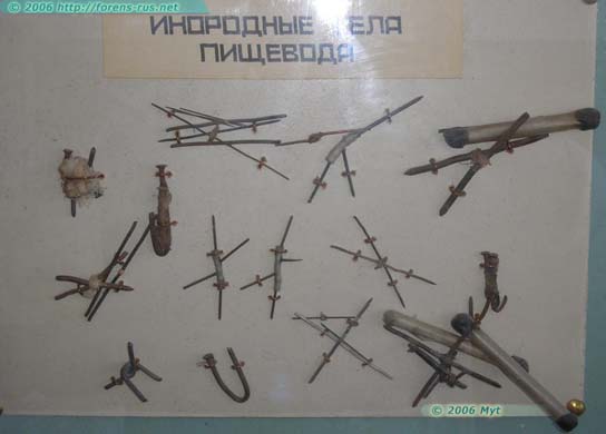 Инородные тела, извлеченные из заключенных в одином из стационаров системы УИН на Cеверном Урале (5 фото)