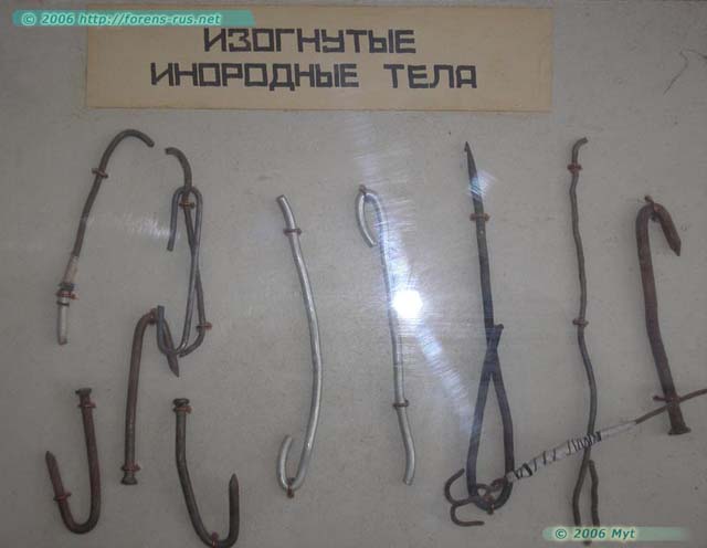 Инородные тела, извлеченные из заключенных в одином из стационаров системы УИН на Cеверном Урале (5 фото)