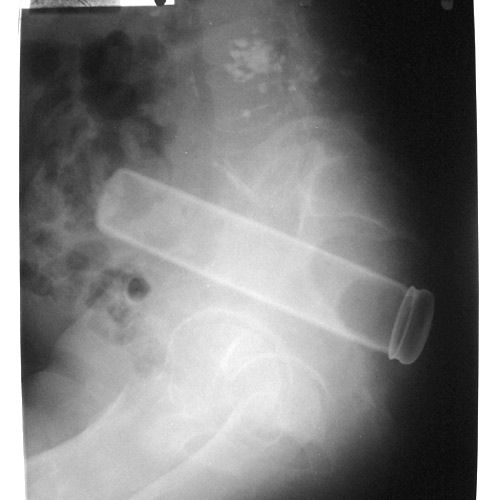 Под лучами рентгена (22 фото)