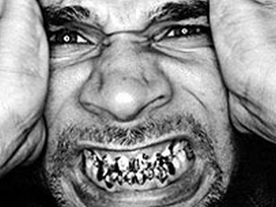 Украшаем зубы (52 фото)