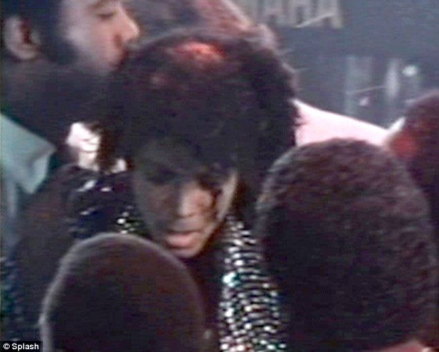 Причина смерти Майкла Джексона кроется в истории 25-летней давности (12 фото)