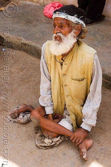 Попрошайки-калеки из Индии (17 фото)