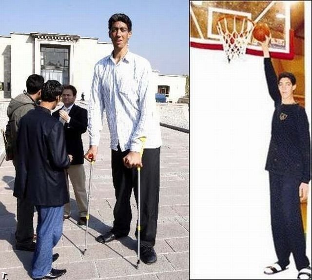Султан Косен - самый высокий человек в мире (26 фото)