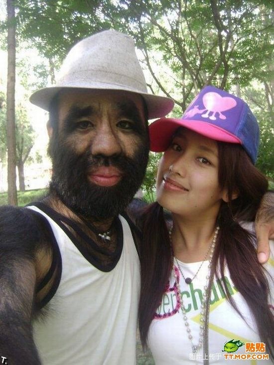 Самый волосатый человек в мире и его девушка (11 фото)