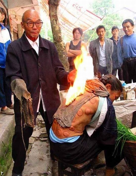 Уличная медицина в Китае (7 фото)