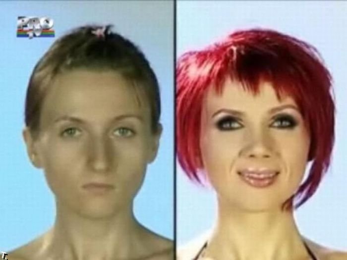 Румынское шоу. До и после пластической операции (31 фото)