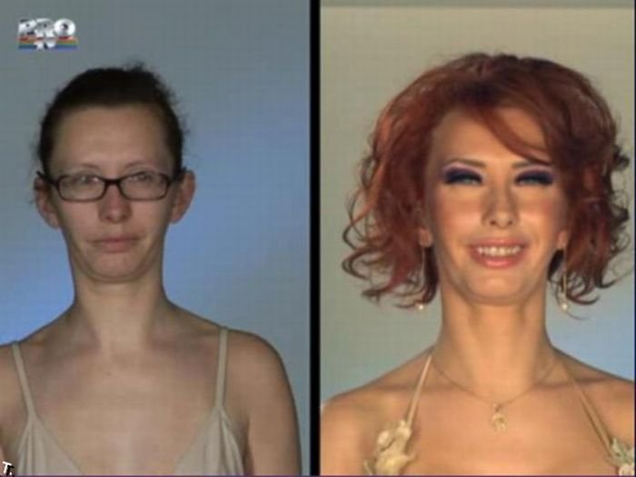 Румынское шоу. До и после пластической операции (31 фото)