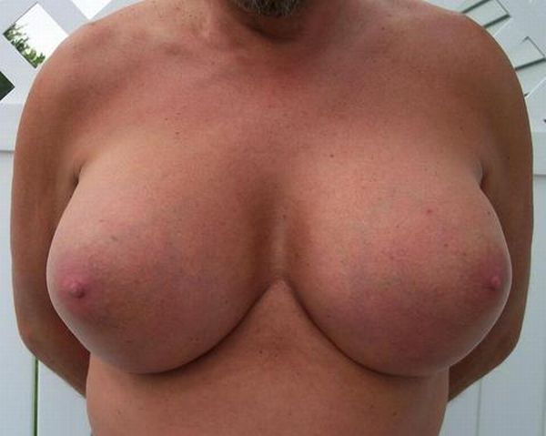 Жесть дня. Мужчина с женской грудью (4 фото)