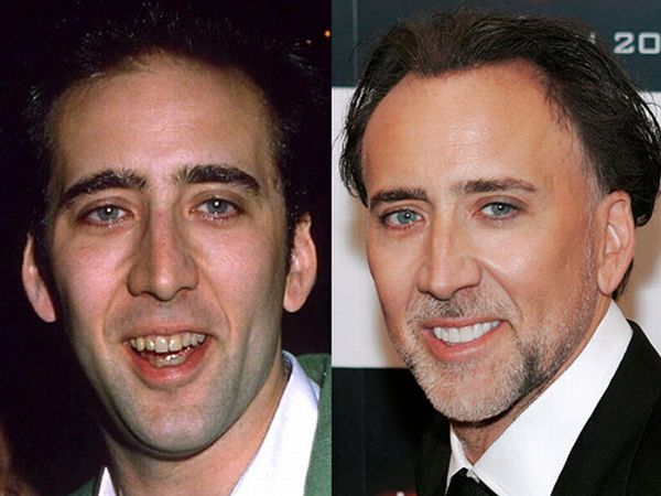 Улыбки знаменитостей. До и после (10 фото)