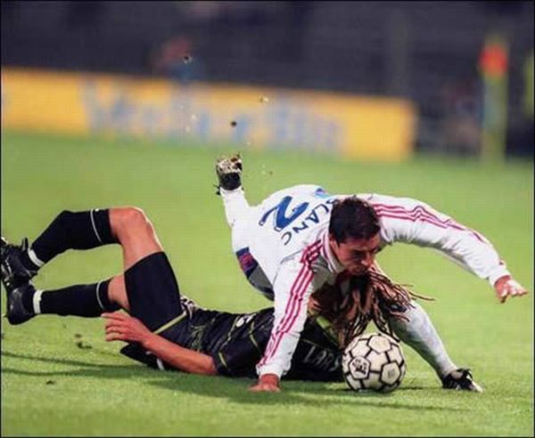 Худшие футбольные травмы (15 фото)