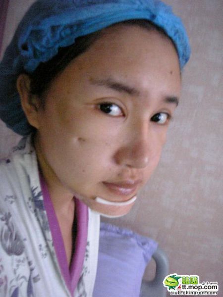 Китаянка до и после пластической операции (13 фото)