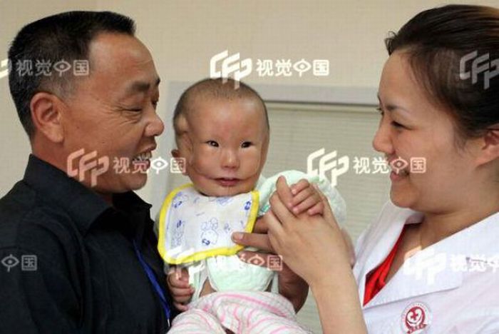 Китайский мальчик с врожденной маской на лице (5 фото)