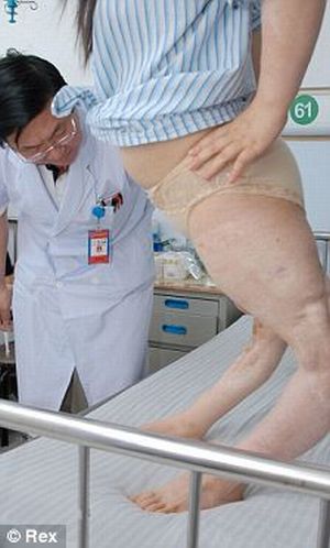 Китайская девушка с перекрученными ногами (4 фото)