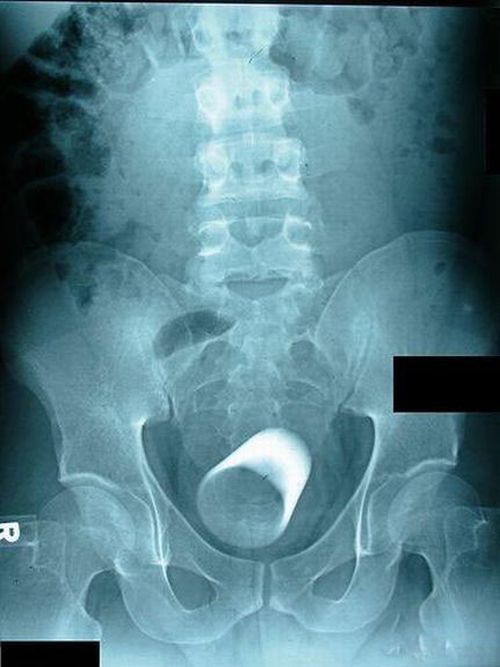 Самые странные снимки рентгена (20 фото)