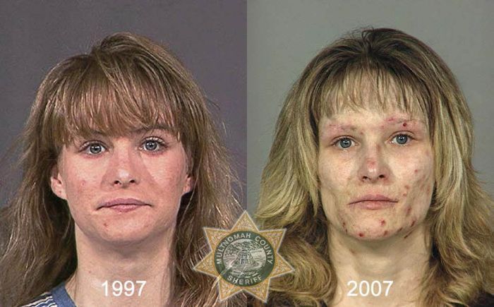 До и после метамфетамина (22 фото)