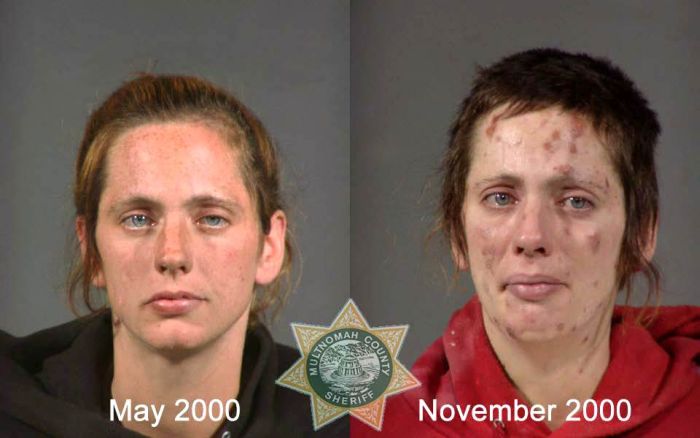 До и после метамфетамина (22 фото)