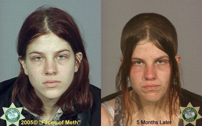 До и после метамфетамина. Часть 2 (38 фото)