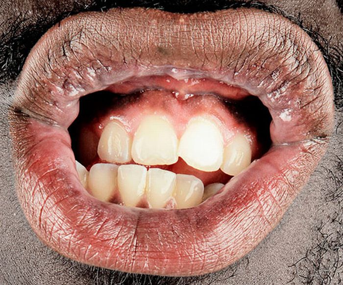 Фотографии человеческого рта (17 фото)