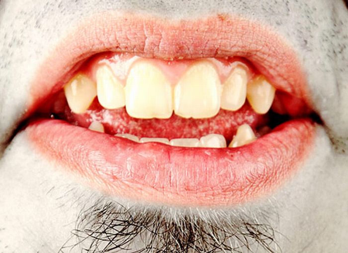Фотографии человеческого рта (17 фото)