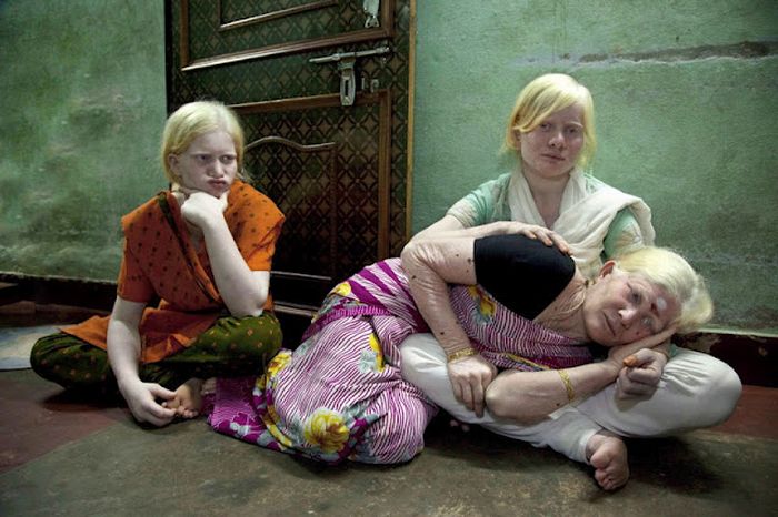 Самая большая семья альбиносов (17 фото)