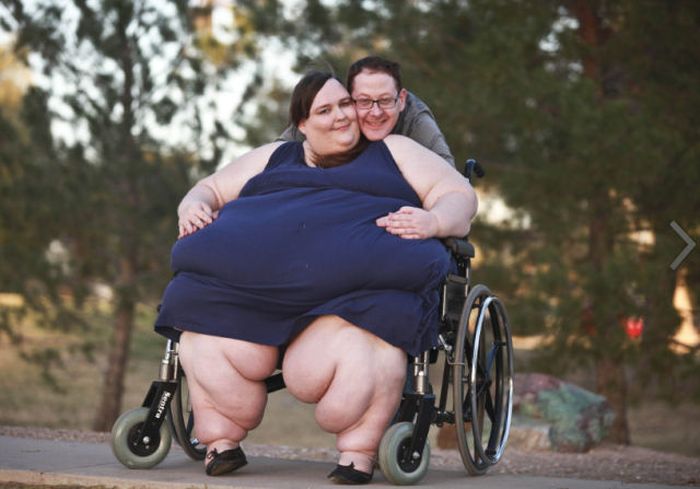 Люди, страдающие от ожирения (17 фото)