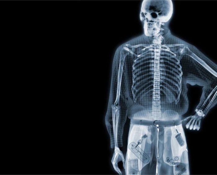 Разные предметы в рентгеновских лучах (56 фото)