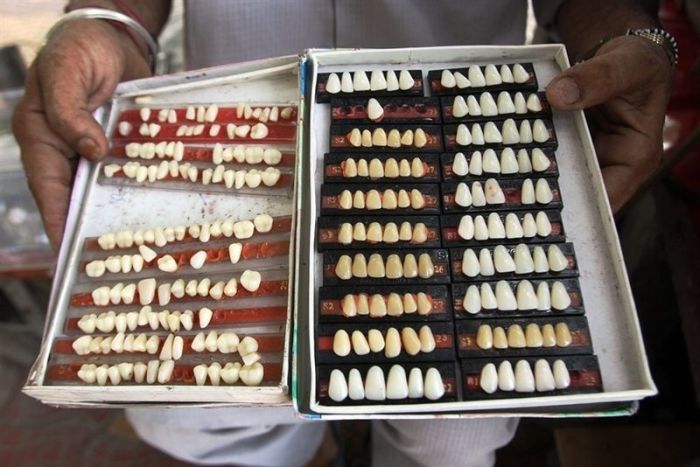 Частные стоматологи в Индии (5 фото)