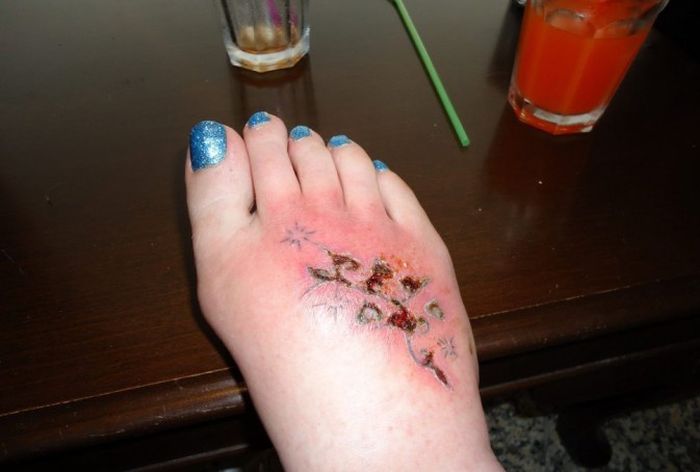 Туристка чуть не лишилась ноги из-за татуировки (7 фото)