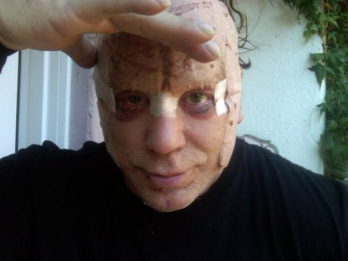 Микки Рурк сделал очередную пластику лица (7 фото)