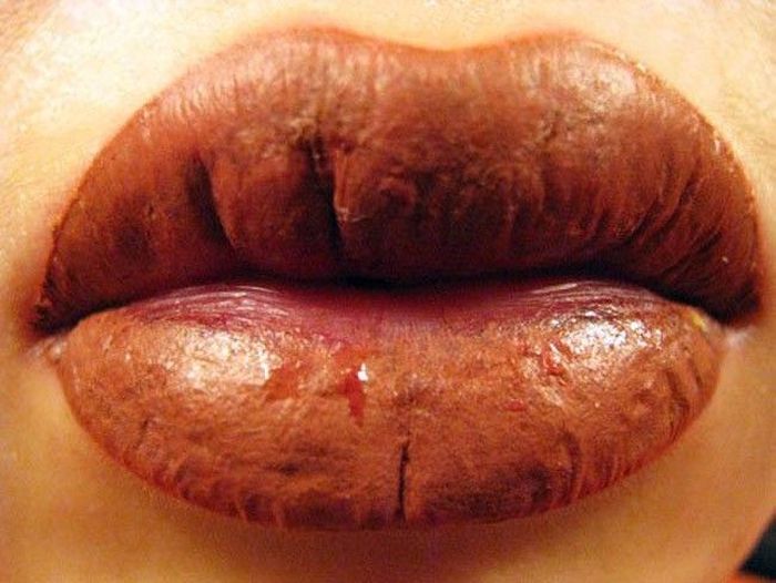 Болезненный процесс татуажа губ (7 фото)