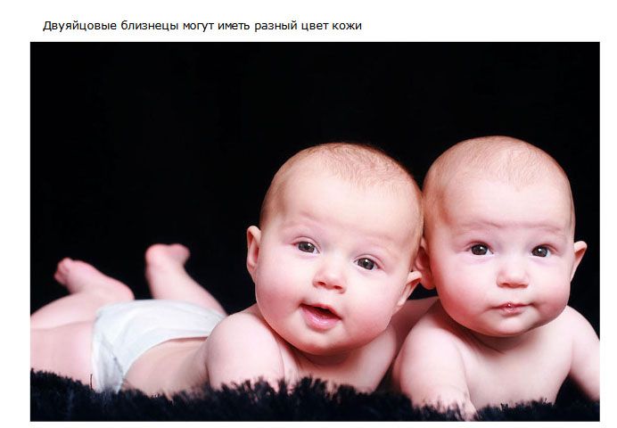 Интересные факты о близнецах (21 фото)