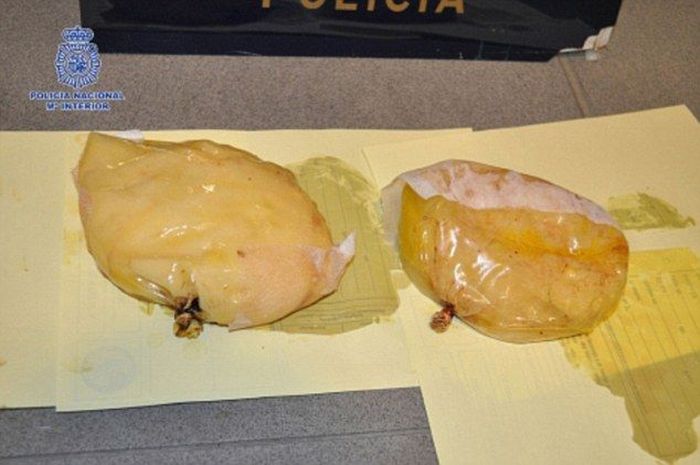 Кокаиновые импланты для транспортировки наркотиков через границу (2 фото)