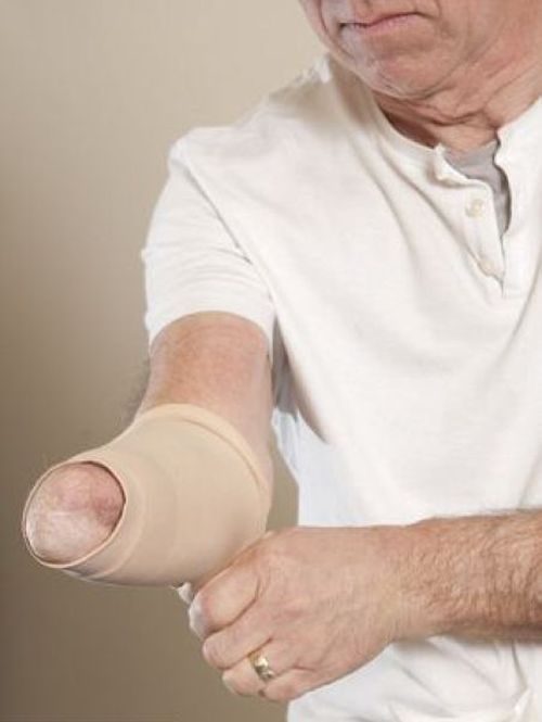 Бионические конечности способны заменить поврежденные руки и ноги (10 фото)