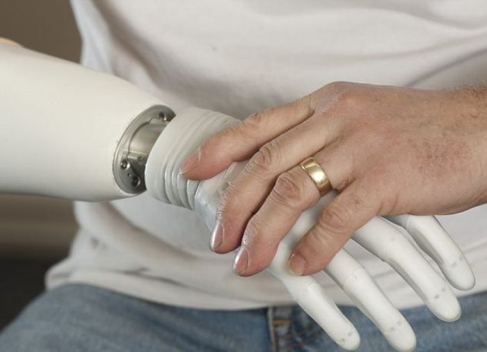Бионические конечности способны заменить поврежденные руки и ноги (10 фото)