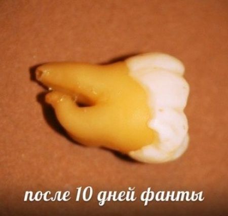 ТОП-10 напитков, которые разрушают наши зубы (10 фото)