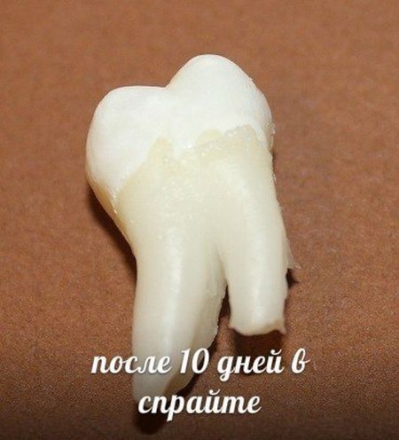ТОП-10 напитков, которые разрушают наши зубы (10 фото)