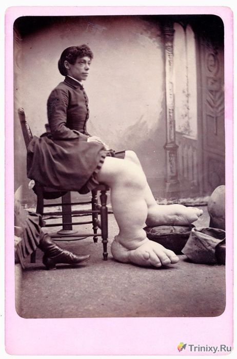 Очень необычная серия фотографий 1870-1880х годов (17 фото)