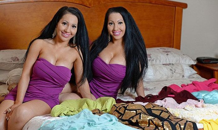 Сестры-близняшки - жертвы пластической хирургии (24 фото)