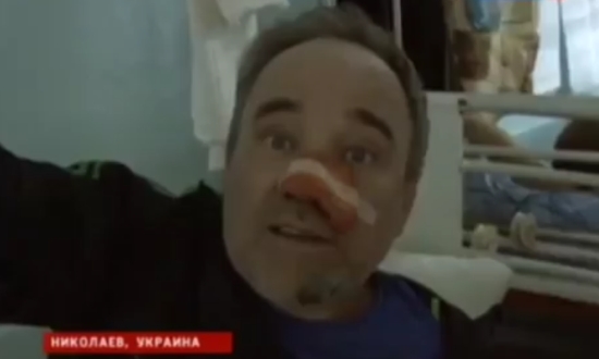Фэйл госпропаганды: наемник Майдана и пострадавший в одном лице
