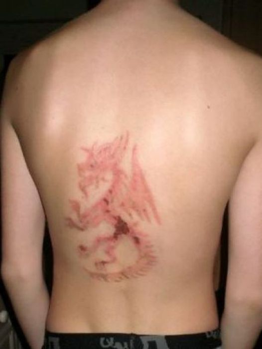 Временные тату могут стать шрамированием на всю жизнь (7 фото)