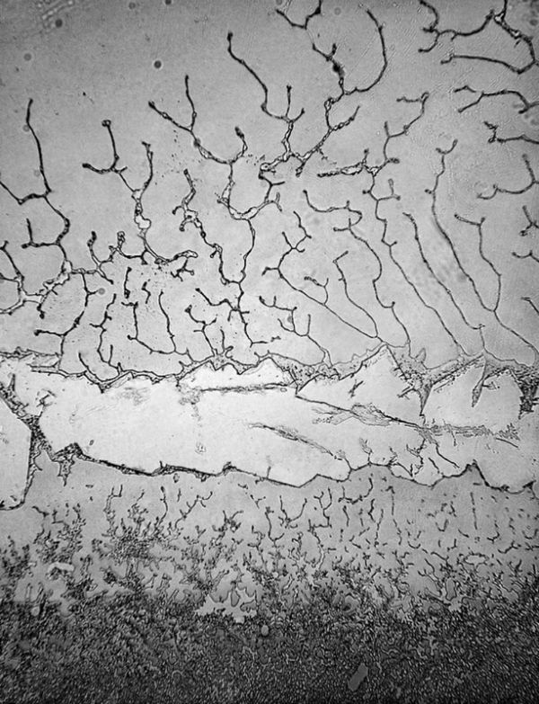 Структура человеческих слёз под электронным микроскопом (7 фото)