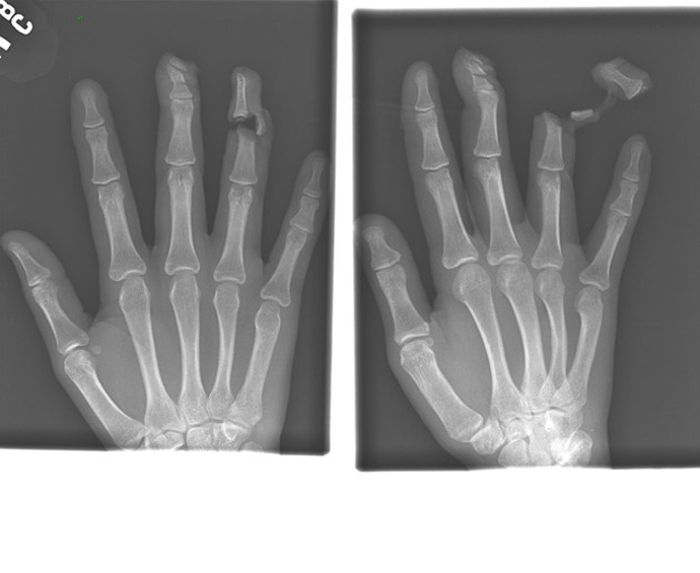 Жуткие рентгеновские снимки (22 фото)