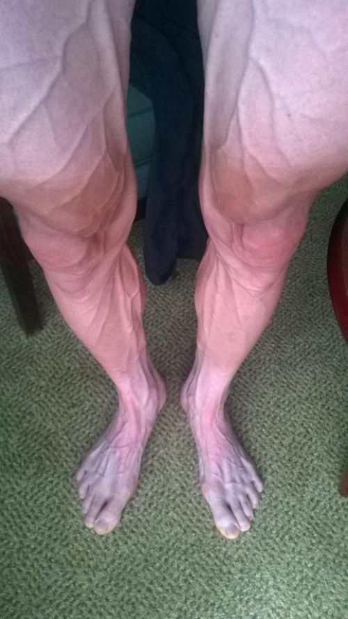 Ноги велогонщика после продолжительной гонки (2 фото)