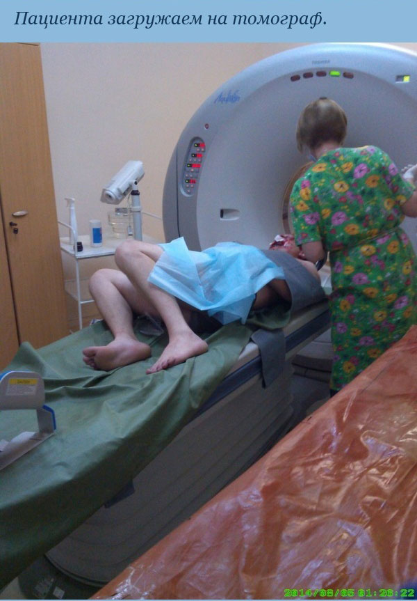 Врач-рентгенолог о пациентах с его ночного дежурства (6 фото)