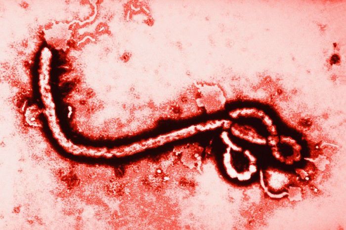 Факты о вирусе Эбола (10 фото)