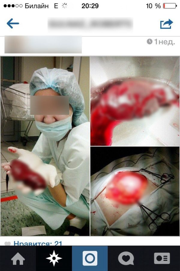Шокирующие селфи с пациентом на операционном столе (5 фото)