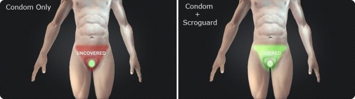Scroguard – мужские трусы для еще более безопасного секса (6 фото)